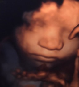 Wonderful World of Bree